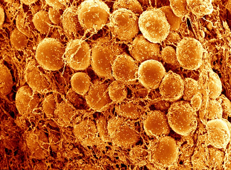 This is a scanning electron micrograph of adipose tissue, showing adipocytes which are computer-coloured orange.