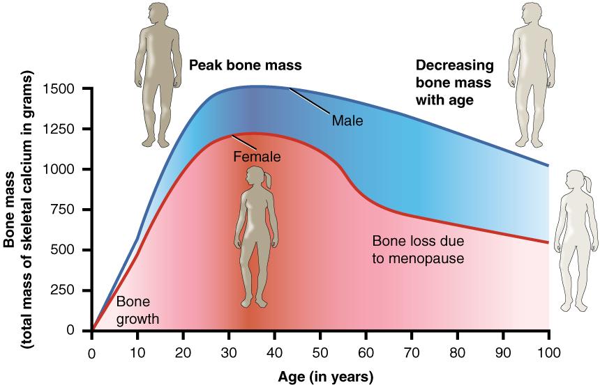 This graph shows bone mass (total mass os skeletal calcium in grams) on the y-axis, and age (in years) on the x-axis. It shows peak bone mass for both men and women is about 30 years of age, with men reaching a higher peak bone mass than women. It then shows a steady decline in peak bone mass with age, starting about 40, with women losing bone mass more quickly than men, especially during menopause.